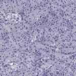 RGS20 Antibody in Immunohistochemistry (Paraffin) (IHC (P))