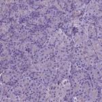 JAK3 Antibody in Immunohistochemistry (Paraffin) (IHC (P))