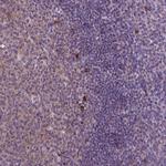 JAK3 Antibody in Immunohistochemistry (Paraffin) (IHC (P))