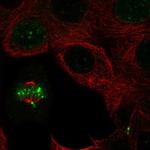 INCENP Antibody in Immunocytochemistry (ICC/IF)