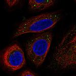 B-Raf Antibody in Immunocytochemistry (ICC/IF)