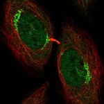 UHMK1 Antibody in Immunocytochemistry (ICC/IF)