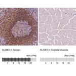 ALOX5 Antibody