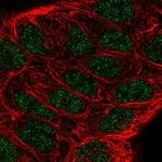 ALOX5 Antibody in Immunocytochemistry (ICC/IF)