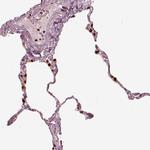 ALOX5 Antibody in Immunohistochemistry (Paraffin) (IHC (P))