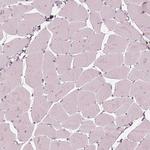 ALOX5 Antibody in Immunohistochemistry (Paraffin) (IHC (P))