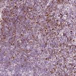 ALOX5 Antibody in Immunohistochemistry (Paraffin) (IHC (P))