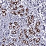 TRPS1 Antibody in Immunohistochemistry (Paraffin) (IHC (P))