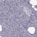 TRPS1 Antibody in Immunohistochemistry (Paraffin) (IHC (P))