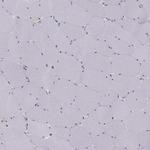 TRPS1 Antibody in Immunohistochemistry (Paraffin) (IHC (P))