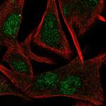 TBPL1 Antibody in Immunocytochemistry (ICC/IF)