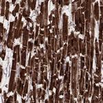 NDUFA7 Antibody in Immunohistochemistry (Paraffin) (IHC (P))