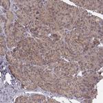 NDUFA7 Antibody in Immunohistochemistry (Paraffin) (IHC (P))