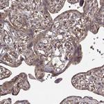 MYPT1 Antibody in Immunohistochemistry (Paraffin) (IHC (P))