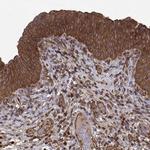 MYPT1 Antibody in Immunohistochemistry (Paraffin) (IHC (P))