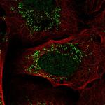 PI3K p55 gamma Antibody in Immunocytochemistry (ICC/IF)