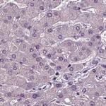 RCOR3 Antibody in Immunohistochemistry (Paraffin) (IHC (P))