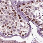 RCOR3 Antibody in Immunohistochemistry (Paraffin) (IHC (P))