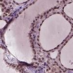 RCOR3 Antibody in Immunohistochemistry (Paraffin) (IHC (P))