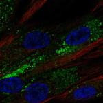 PPAP2B Antibody in Immunocytochemistry (ICC/IF)