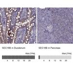 LZTR2 Antibody