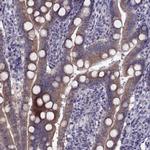 LZTR2 Antibody in Immunohistochemistry (Paraffin) (IHC (P))