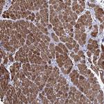 MLCK Antibody in Immunohistochemistry (Paraffin) (IHC (P))