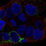 CLN6 Antibody in Immunocytochemistry (ICC/IF)