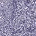 LRRC50 Antibody in Immunohistochemistry (Paraffin) (IHC (P))