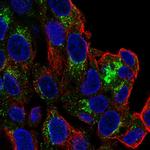 SLC6A4 Antibody in Immunocytochemistry (ICC/IF)