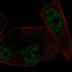 NR3C2 Antibody in Immunocytochemistry (ICC/IF)