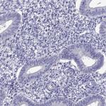 OXCT2 Antibody in Immunohistochemistry (Paraffin) (IHC (P))