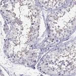 OXCT2 Antibody in Immunohistochemistry (Paraffin) (IHC (P))