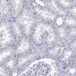 LOR Antibody in Immunohistochemistry (Paraffin) (IHC (P))