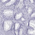 LOR Antibody in Immunohistochemistry (Paraffin) (IHC (P))