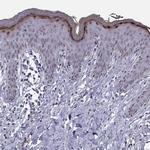 LOR Antibody in Immunohistochemistry (Paraffin) (IHC (P))