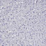 SLC30A8 Antibody in Immunohistochemistry (Paraffin) (IHC (P))