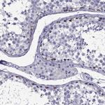 DNAH17 Antibody in Immunohistochemistry (Paraffin) (IHC (P))