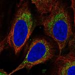 DEGS1 Antibody in Immunocytochemistry (ICC/IF)