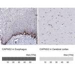 CAPNS2 Antibody