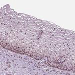 HEYL Antibody in Immunohistochemistry (Paraffin) (IHC (P))