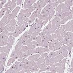 HEYL Antibody in Immunohistochemistry (Paraffin) (IHC (P))