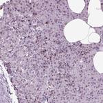 HEYL Antibody in Immunohistochemistry (Paraffin) (IHC (P))