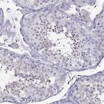 TEX14 Antibody in Immunohistochemistry (Paraffin) (IHC (P))