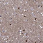 NPTX1 Antibody in Immunohistochemistry (Paraffin) (IHC (P))