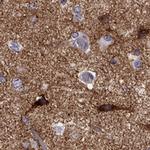 NPTX1 Antibody in Immunohistochemistry (Paraffin) (IHC (P))