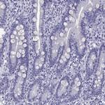 LOR Antibody in Immunohistochemistry (Paraffin) (IHC (P))