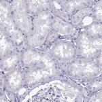 LOR Antibody in Immunohistochemistry (Paraffin) (IHC (P))