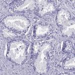 LOR Antibody in Immunohistochemistry (Paraffin) (IHC (P))