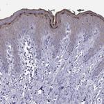 LOR Antibody in Immunohistochemistry (Paraffin) (IHC (P))